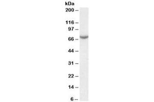 Western blot testing of human placenta lysate with Arylsulfatase C antibody at 0. (STS antibody)