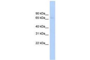 Image no. 1 for anti-ATP-Binding Cassette, Sub-Family F (GCN20), Member 2 (ABCF2) (AA 503-552) antibody (ABIN6744747) (ABCF2 antibody  (AA 503-552))