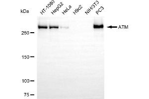 Western blotting analysis using ATM antibody (ABIN7797668). (Recombinant ATM antibody)