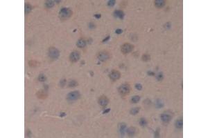 Figure. (NME1 antibody  (AA 6-147))
