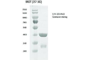 Western Blotting (WB) image for Bromodomain, Testis-Specific (BRDT) (AA 257-382) protein (GST tag) (ABIN2669727)