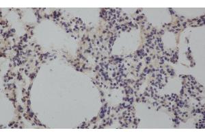 Immunohistochemistry of paraffin-embedded Rat lung using MMP8 Polyclonal Antibody at dilution of 1:50 (MMP8 antibody)