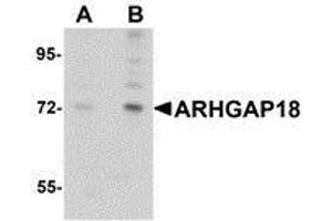 Western blot analysis of ARHGAP18 in 3T3 cell lysate with AP30079PU-N ARHGAP18 antibody at (A) 1 and (B) 2 μg/ml. (ARHGAP18 antibody  (C-Term))