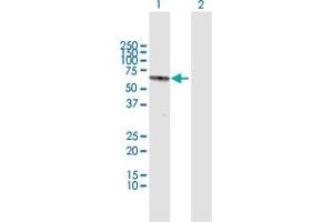 Western Blot analysis of RAG2 expression in transfected 293T cell line by RAG2 MaxPab polyclonal antibody. (RAG2 antibody  (AA 1-527))