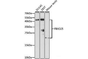 Western blot analysis of extracts of various cell lines using FBXO25 Polyclonal Antibody at dilution of 1:1000.