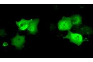 Anti-C21orf59 mouse monoclonal antibody (ABIN2452867) immunofluorescent staining of COS7 cells transiently transfected by pCMV6-ENTRY C21orf59 (RC200169). (C21orf59 antibody)