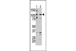 The MAP3K9 polyclonal antibody  is used in Western blot to detect MAP3K9 in A-375 cell lysate (lane 1) and rat testis tissue lysate (lane 2) . (MAP3K9 antibody  (C-Term))