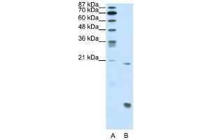 WB Suggested Anti-RUNX1  Antibody Titration: 0. (RUNX1 antibody  (N-Term))