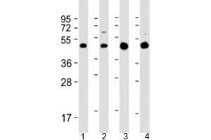 Western blot testing of 1) rat C6 cell lysate, 2) human SH-SY5Y cell lysate, 3) human brain lysate and 4) mouse brain lysate with GLUT3 antibody at 1:2000. (SLC2A3 antibody  (AA 432-463))