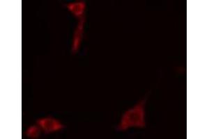 ABIN6272315 staining COLO205 cells by IF/ICC.