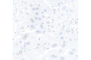 Immunohistochemistry (IHC) image for anti-Nucleoprotein TPR (TPR) (C-Term) antibody (ABIN7448922)
