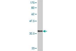 Western Blot detection against Immunogen (37 KDa) . (VPS41 antibody  (AA 755-853))
