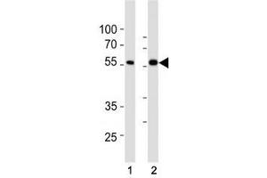 SMAD6 antibody western blot analysis in (1) HepG2 and (2) HT29 lysate. (SMAD6 antibody  (AA 358-386))