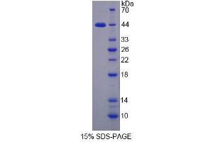 SDS-PAGE (SDS) image for Cathepsin W (CTSW) (AA 22-376) protein (His tag) (ABIN6239219) (Cathepsin W Protein (CTSW) (AA 22-376) (His tag))