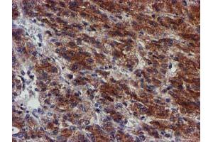 Image no. 1 for anti-Makorin Ring Finger Protein 1 (MKRN1) antibody (ABIN1499486) (MKRN1 antibody)