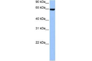 Collagen Type IV alpha 3 antibody used at 1 ug/ml to detect target protein.