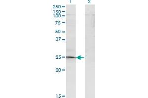 Western Blot analysis of TGIF2 expression in transfected 293T cell line by TGIF2 monoclonal antibody (M15), clone 2A4. (TGIF2 antibody  (AA 1-237))