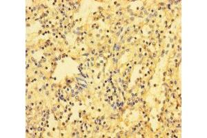 Immunohistochemistry of paraffin-embedded human spleen tissue using ABIN7171517 at dilution of 1:100 (ABI3BP antibody  (AA 601-900))