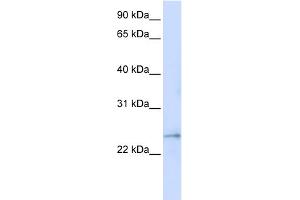 WB Suggested Anti-FAM156A Antibody Titration:  0. (FAM156A antibody  (Middle Region))
