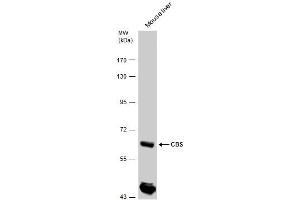 WB Image CBS antibody detects CBS protein by western blot analysis. (CBS antibody)
