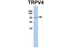 Host:  Rabbit  Target Name:  TRPV4  Sample Type:  HT1080  Antibody Dilution:  1. (TRPV4 antibody  (Middle Region))