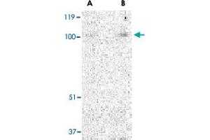 Western blot analysis of TRPC3 in mouse heart tissue lysate with TRPC3 polyclonal antibody  at (A) 1 and (B) 2 ug/mL . (TRPC3 antibody  (N-Term))