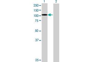 Western Blot analysis of ITGB2 expression in transfected 293T cell line by ITGB2 MaxPab polyclonal antibody. (Integrin beta 2 antibody  (AA 1-769))