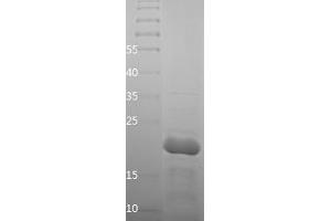 Western Blotting (WB) image for Lamin A/C (LMNA) (AA 26-198) protein (His tag) (ABIN7123712) (Lamin A/C Protein (LMNA) (AA 26-198) (His tag))
