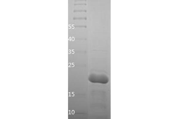 Lamin A/C Protein (LMNA) (AA 26-198) (His tag)