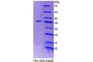 SDS-PAGE (SDS) image for Host Cell Factor C1 (VP16-Accessory Protein) (HCFC1) (AA 52-258) protein (His tag) (ABIN4989067)