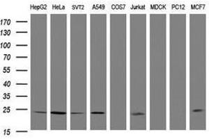 Image no. 1 for anti-Ras-Like Without CAAX 2 (RIT2) antibody (ABIN1500714) (RIT2 antibody)