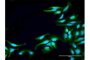 Immunofluorescence of purified MaxPab antibody to TNK2 on HeLa cell. (TNK2 antibody  (AA 1-352))