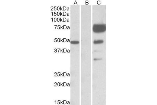 Angiopoietin 1 antibody  (Internal Region)