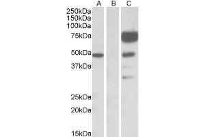 HEK293 lysate (10ug protein in RIPA buffer) overexpressing Human ANGPT1 with DYKDDDDK tag probed with ABIN768552(1ug/ml) in Lane A and probed with anti- DYKDDDDK Tag (1/1000) in lane C. (Angiopoietin 1 antibody  (Internal Region))