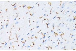 Immunohistochemistry of paraffin-embedded Mouse heart using Phospho-GJA1(S368) Polyclonal Antibody at dilution of 1:200 (40x lens). (Connexin 43/GJA1 antibody  (pSer368))