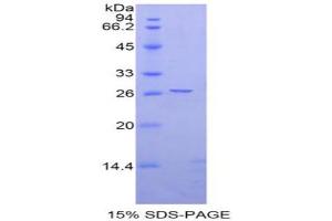 SDS-PAGE analysis of Rat Ephrin A4 Protein. (EFNA4 Protein)