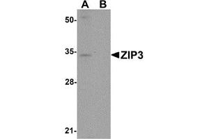 Western blot analysis of ZIP3 in mouse lung tissue lysate with ZIP3 antibody at 1 μg/ml in (A) the absence and (B) the presence of blocking peptide. (SLC39A3 antibody  (Center))
