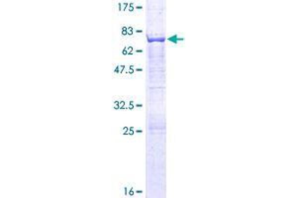 AP3M1 Protein (AA 1-418) (GST tag)