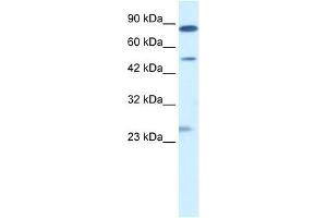 WB Suggested Anti-CLIC6 Antibody Titration:  0. (CLIC6 antibody  (Middle Region))