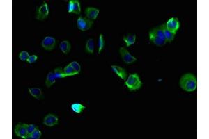 Immunofluorescent analysis of MCF-7 cells using ABIN7173179 at dilution of 1:100 and Alexa Fluor 488-congugated AffiniPure Goat Anti-Rabbit IgG(H+L) (TMEM255B antibody  (AA 221-356))