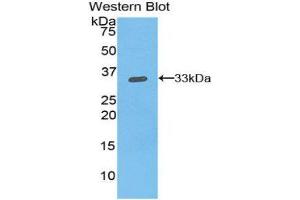Western Blotting (WB) image for anti-Integrin beta 1 (ITGB1) (AA 454-714) antibody (ABIN1859501)