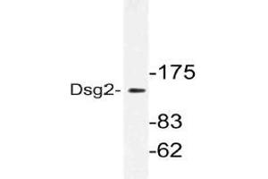 Western blot (WB) analysis of Dsg2 antibody in extracts from HeLa cells. (Desmoglein 2 antibody)