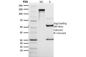 SDS-PAGE Analysis Purified HER-2 Mouse Monoclonal Antibody (SPM172). (ErbB2/Her2 antibody  (AA 311-462))