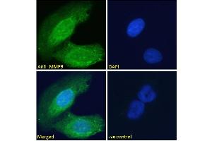 ABIN5539846 Immunofluorescence analysis of paraformaldehyde fixed U2OS cells, permeabilized with 0. (MMP 9 antibody  (Internal Region))