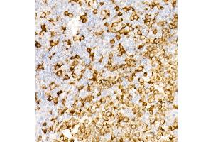 Immunohistochemistry of paraffin-embedded Human tonsil using CD74 antibody (ABIN7267759) at dilution of 1:100 (40x lens). (CD74 antibody)