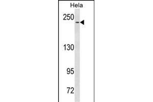 NOTCH3 Antibody  (ABIN1537680 and ABIN2843860) western blot analysis in Hela cell line lysates (35 μg/lane). (NOTCH3 antibody  (C-Term))
