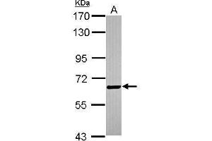 WB Image Sample (30 ug of whole cell lysate) A: Jurkat 7. (BTD antibody)