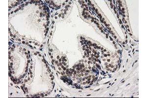 Image no. 1 for anti-Protein Kinase C, epsilon (PRKCE) antibody (ABIN1500229) (PKC epsilon antibody)