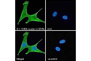 (ABIN185678) Immunofluorescence analysis of paraformaldehyde fixed NIH3T3 cells, permeabilized with 0. (GRIN1/NMDAR1 antibody  (Internal Region))