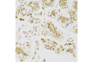 Immunohistochemistry of paraffin-embedded human breast using CASP2 Antibody (ABIN5973353) at dilution of 1/100 (40x lens).